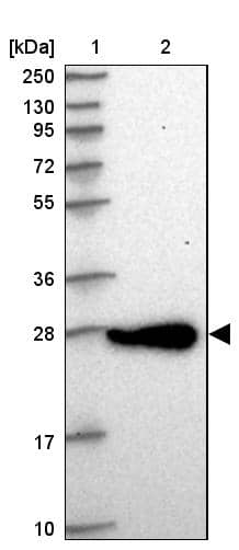 CHCHD6 Antibody - BSA Free Western Blot: CHCHD6 Antibody - BSA Free [NBP1-91779]