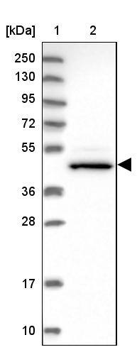 CHST12 Antibody - BSA Free Western Blot: CHST12 Antibody - BSA Free [NBP1-91784]