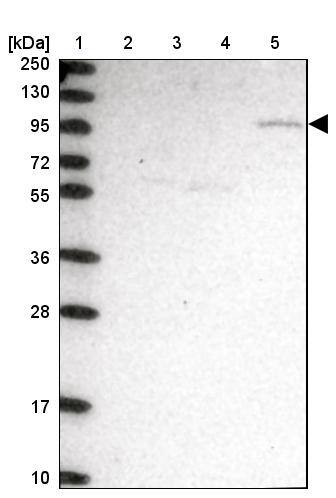 CLCN3 Antibody - BSA Free Western Blot: CLCN3 Antibody - BSA Free [NBP1-91790]