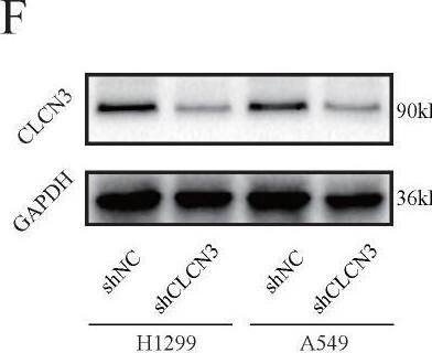CLCN3 Antibody - BSA Free