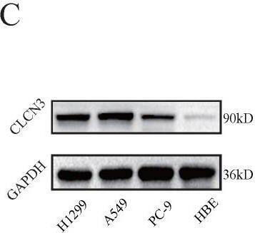 CLCN3 Antibody - BSA Free