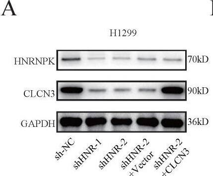 CLCN3 Antibody - BSA Free