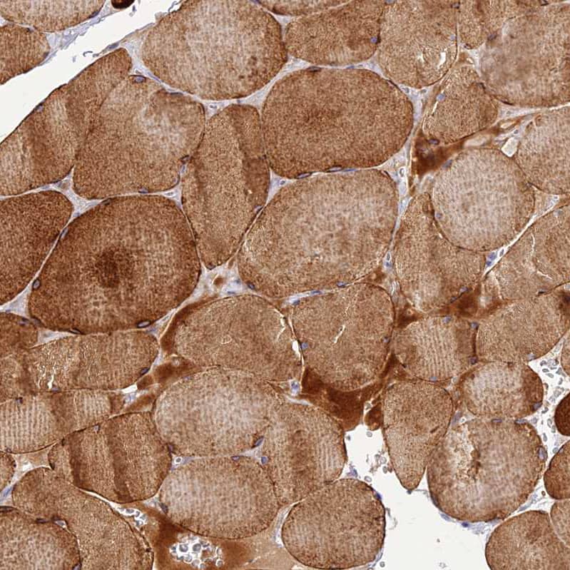 CLIP4 Antibody - BSA Free Immunohistochemistry: CLIP4 Antibody - BSA Free [NBP1-91793]