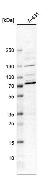 CLIP4 Antibody - BSA Free Western Blot: CLIP4 Antibody - BSA Free [NBP1-91793]