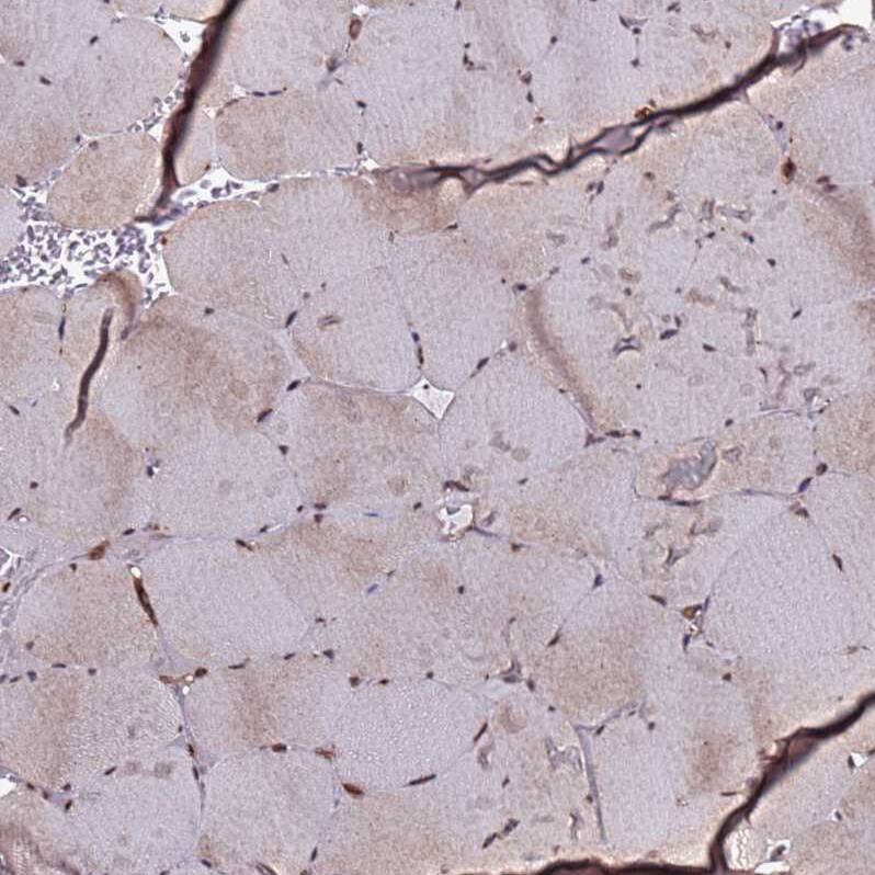 CLK3 Antibody - BSA Free Immunohistochemistry: CLK3 Antibody - BSA Free [NBP1-91794]