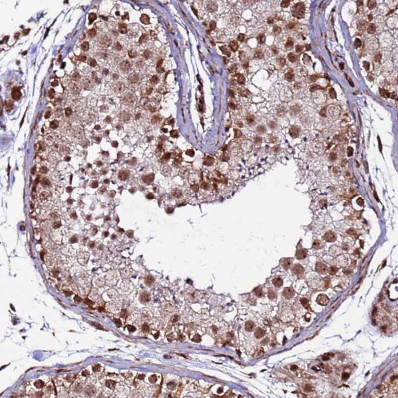 CLK3 Antibody - BSA Free Immunohistochemistry: CLK3 Antibody - BSA Free [NBP1-91794]