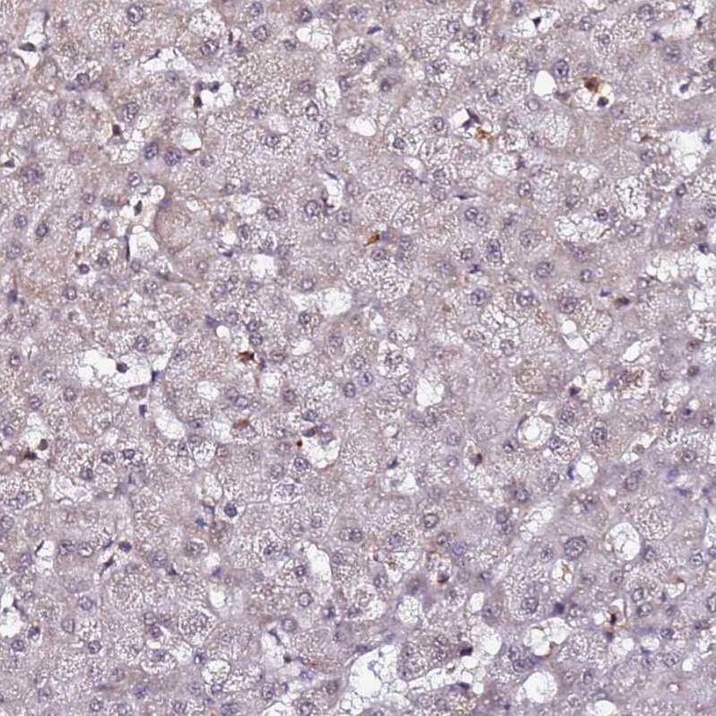 CLK3 Antibody - BSA Free Immunohistochemistry: CLK3 Antibody - BSA Free [NBP1-91794]