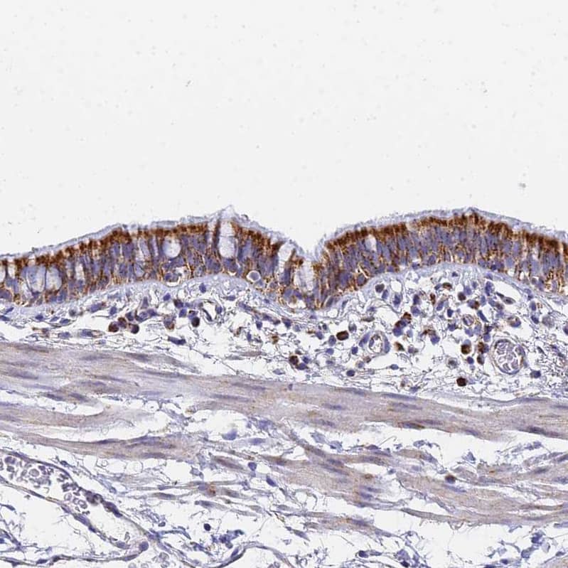 CNIH4 Antibody - BSA Free Immunohistochemistry: CNIH4 Antibody - BSA Free [NBP1-91797]
