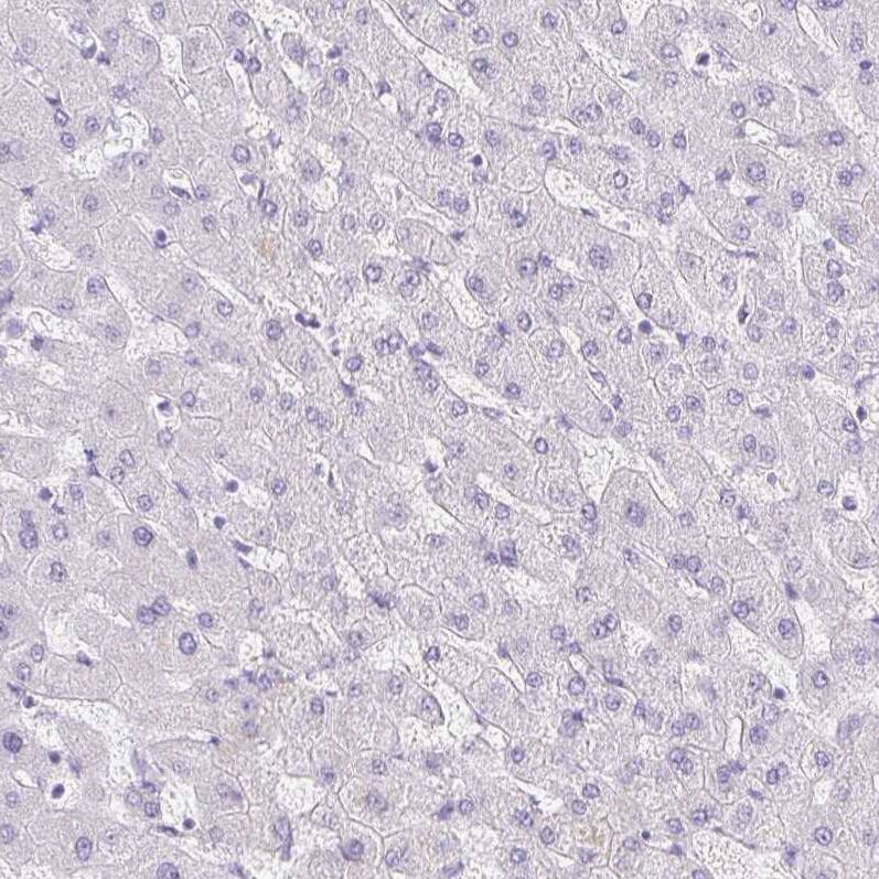 Collagen XVII Antibody - BSA Free Immunohistochemistry: Collagen XVII Antibody - BSA Free [NBP1-91800]