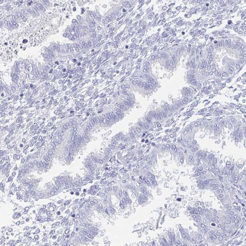 Collagen XVII Antibody - BSA Free Immunohistochemistry: Collagen XVII Antibody - BSA Free [NBP1-91800]