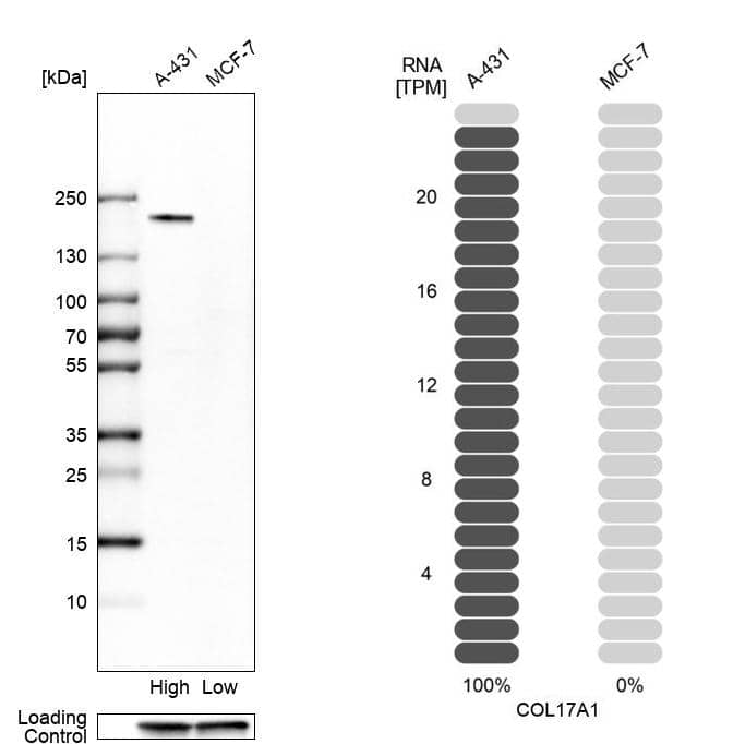 Collagen XVII Antibody - BSA Free Western Blot: Collagen XVII Antibody - BSA Free [NBP1-91800]