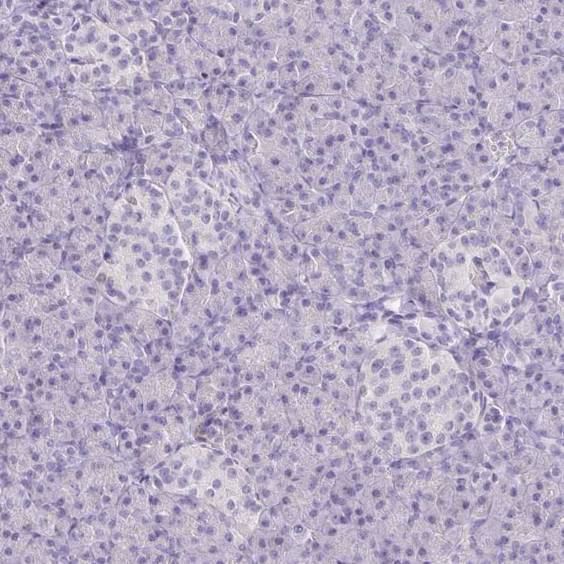 Collagen XVII Antibody - BSA Free Immunohistochemistry: Collagen XVII Antibody - BSA Free [NBP1-91800]