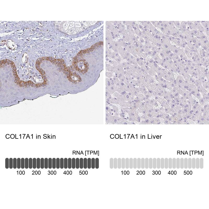 Collagen XVII Antibody - BSA Free Immunohistochemistry: Collagen XVII Antibody - BSA Free [NBP1-91800]