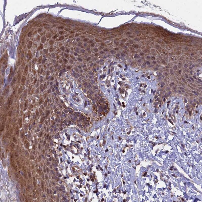 COMMD2 Antibody - BSA Free Immunohistochemistry: COMMD2 Antibody - BSA Free [NBP1-91802]