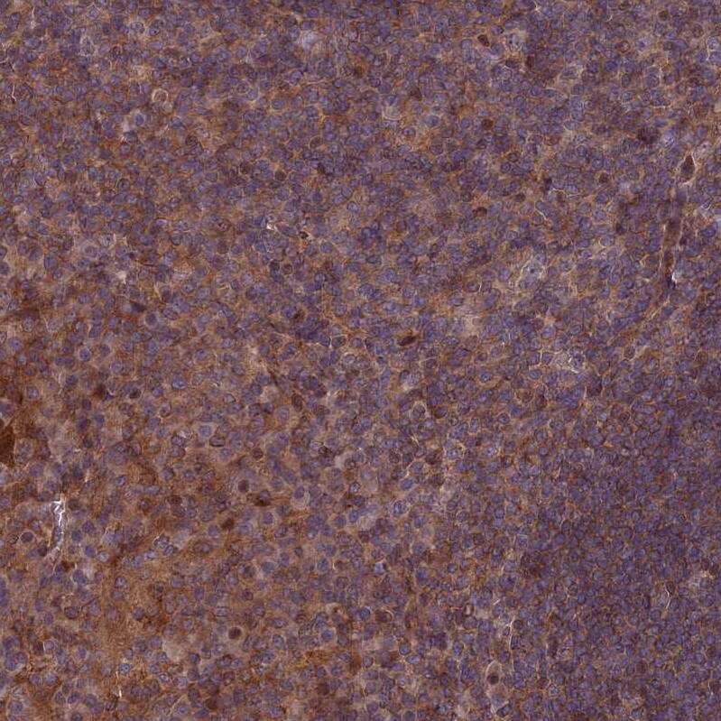 COMMD2 Antibody - BSA Free Immunohistochemistry: COMMD2 Antibody - BSA Free [NBP1-91802]