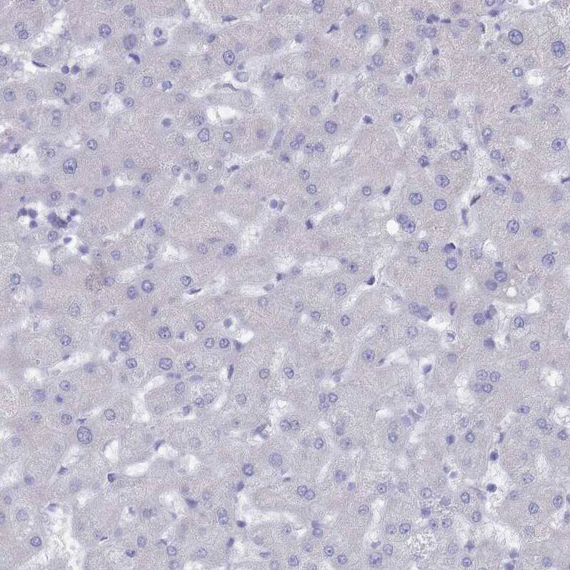 COPS6 Antibody - BSA Free Immunohistochemistry: COPS6 Antibody - BSA Free [NBP1-91805]