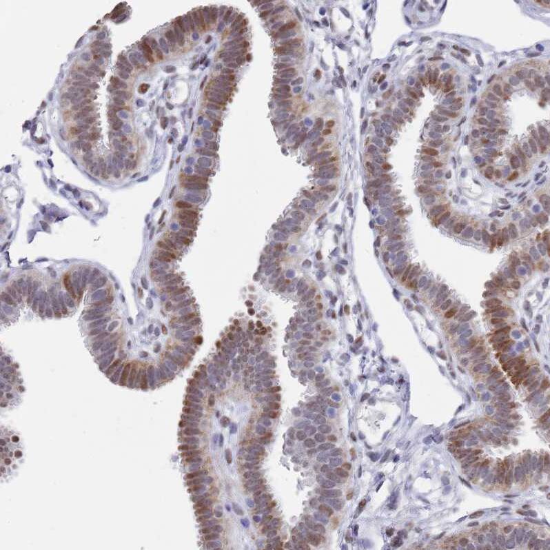 COPS6 Antibody - BSA Free Immunohistochemistry: COPS6 Antibody - BSA Free [NBP1-91805]