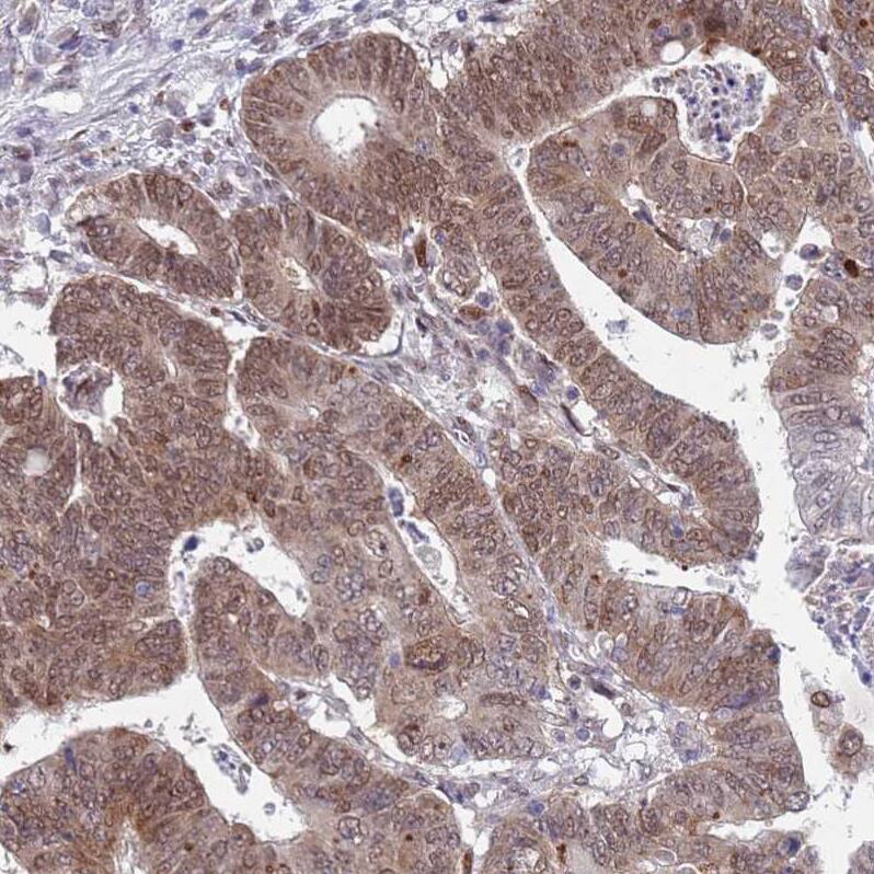 COPS6 Antibody - BSA Free Immunohistochemistry: COPS6 Antibody - BSA Free [NBP1-91805]