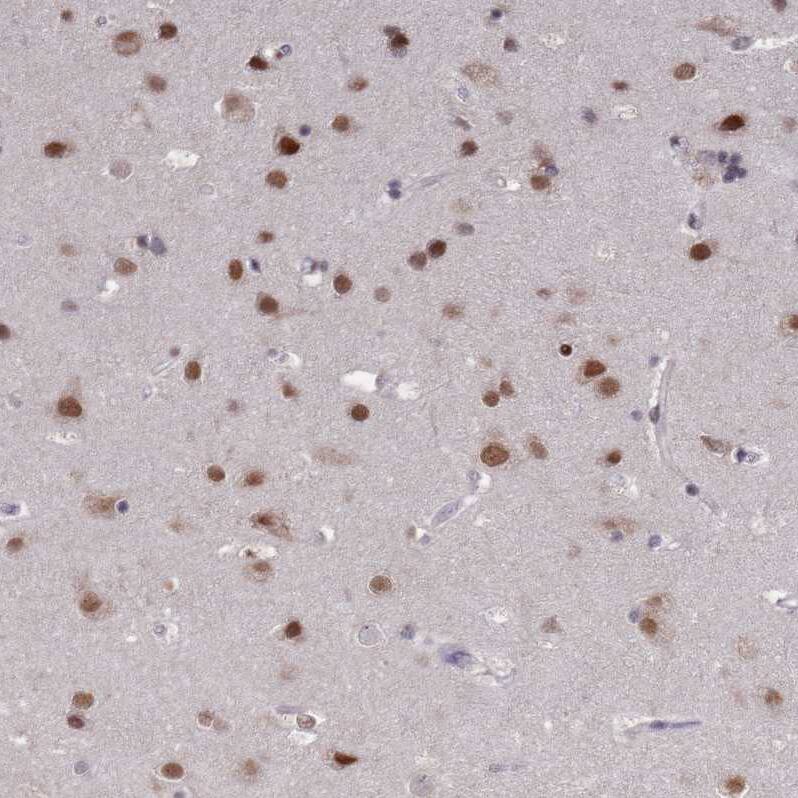 COPS6 Antibody - BSA Free Immunohistochemistry: COPS6 Antibody - BSA Free [NBP1-91805]