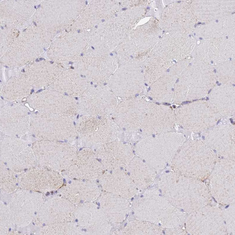 COQ4 Antibody - BSA Free Immunohistochemistry: COQ4 Antibody - BSA Free [NBP1-91806]