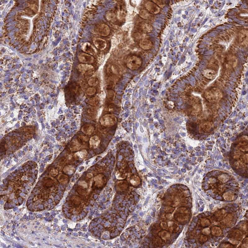 COQ4 Antibody - BSA Free Immunohistochemistry: COQ4 Antibody - BSA Free [NBP1-91806]