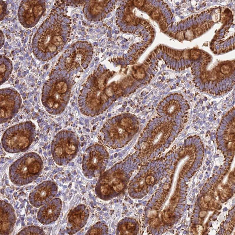 COQ4 Antibody - BSA Free Immunohistochemistry: COQ4 Antibody - BSA Free [NBP1-91806]