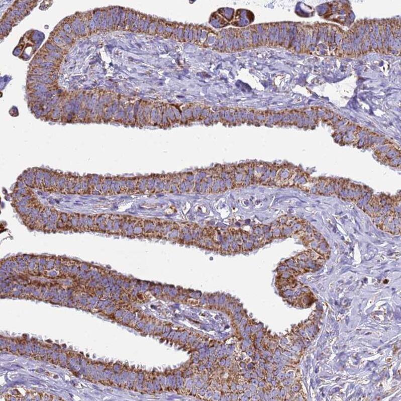 COQ4 Antibody - BSA Free Immunohistochemistry: COQ4 Antibody - BSA Free [NBP1-91806]