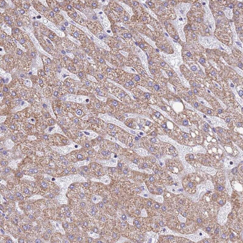 COQ4 Antibody - BSA Free Immunohistochemistry: COQ4 Antibody - BSA Free [NBP1-91806]