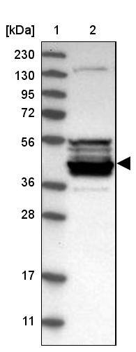 CPA5 Antibody - BSA Free Western Blot: CPA5 Antibody - BSA Free [NBP1-91807]