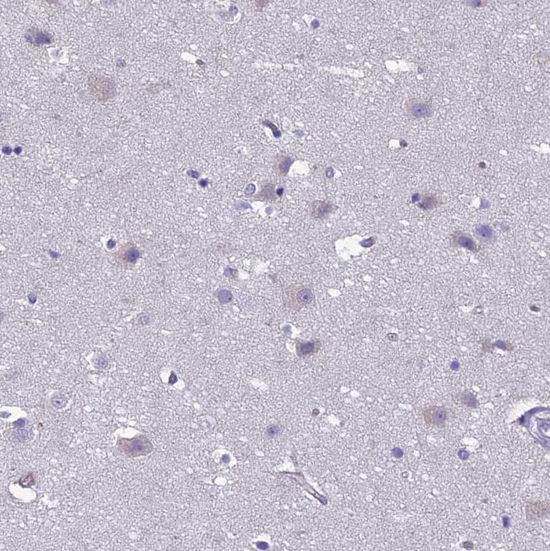 CRB2 Antibody - BSA Free Immunohistochemistry: CRB2 Antibody - BSA Free [NBP1-91809]