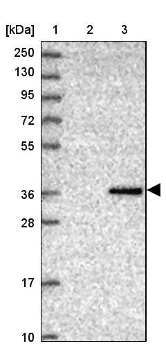CRHBP Antibody - BSA Free Western Blot: CRHBP Antibody - BSA Free [NBP1-91811]