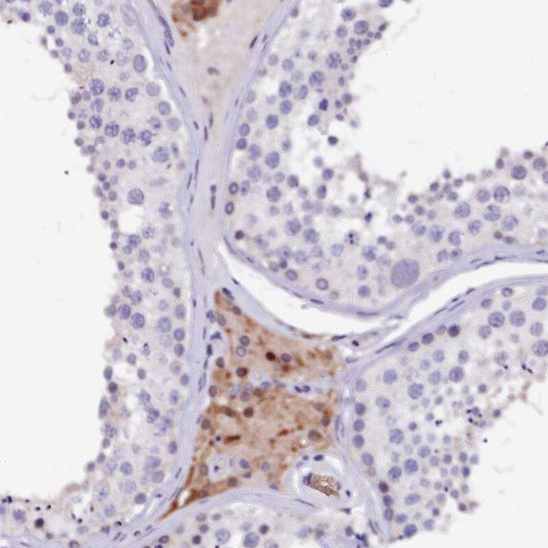 CTDSPL2 Antibody - BSA Free Immunohistochemistry: CTDSPL2 Antibody - BSA Free [NBP1-91814]