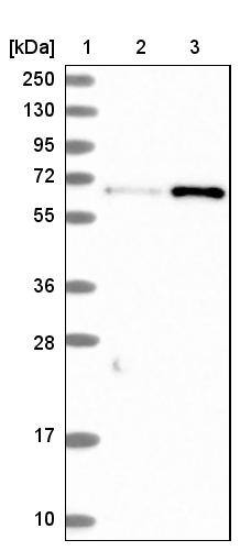 CTDSPL2 Antibody - BSA Free Western Blot: CTDSPL2 Antibody - BSA Free [NBP1-91814]