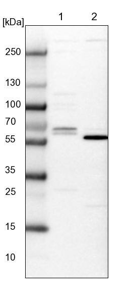 CTDSPL2 Antibody - BSA Free Western Blot: CTDSPL2 Antibody - BSA Free [NBP1-91814]