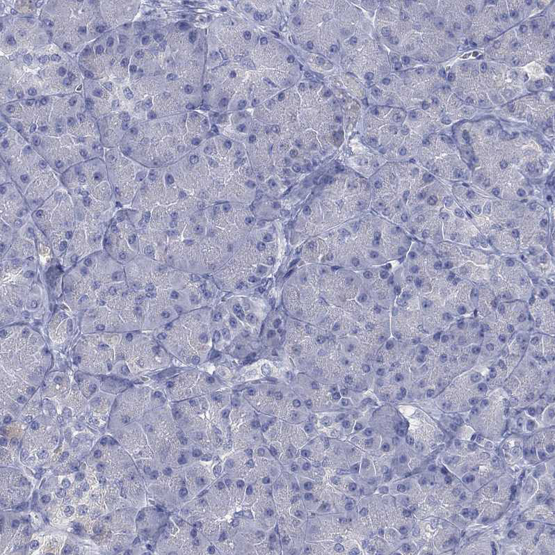 Cytochrome P450 2D6 Antibody - BSA Free Immunohistochemistry: Cytochrome P450 2D6 Antibody - BSA Free [NBP1-91818]