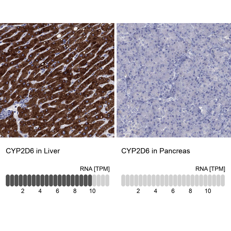 Cytochrome P450 2D6 Antibody - BSA Free Immunohistochemistry: Cytochrome P450 2D6 Antibody - BSA Free [NBP1-91818]