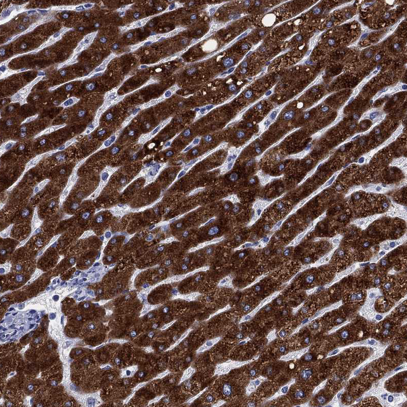 Cytochrome P450 2D6 Antibody - BSA Free Immunohistochemistry: Cytochrome P450 2D6 Antibody - BSA Free [NBP1-91818]