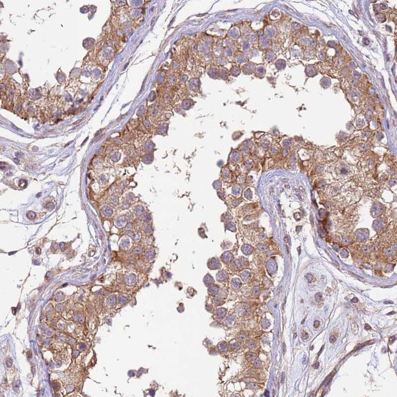 DCAF4 Antibody - BSA Free Immunohistochemistry: DCAF4 Antibody - BSA Free [NBP1-91820]