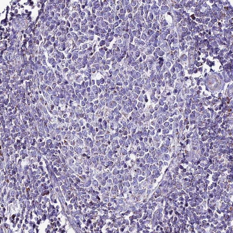 DCI Antibody - BSA Free Immunohistochemistry: DCI Antibody - BSA Free [NBP1-91821]