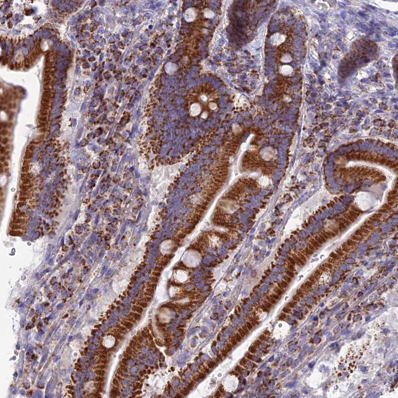 DCI Antibody - BSA Free Immunohistochemistry: DCI Antibody - BSA Free [NBP1-91821]