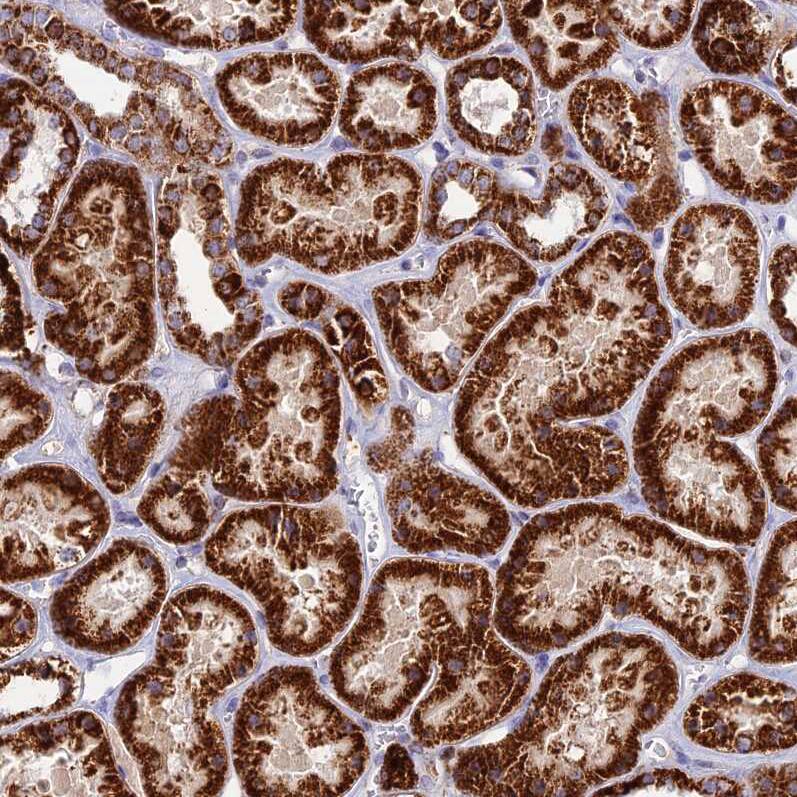DCI Antibody - BSA Free Immunohistochemistry: DCI Antibody - BSA Free [NBP1-91821]