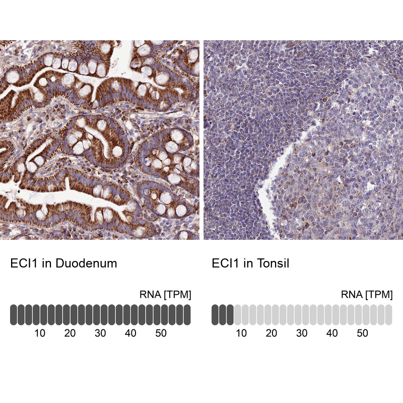 DCI Antibody - BSA Free Immunohistochemistry: DCI Antibody - BSA Free [NBP1-91822]