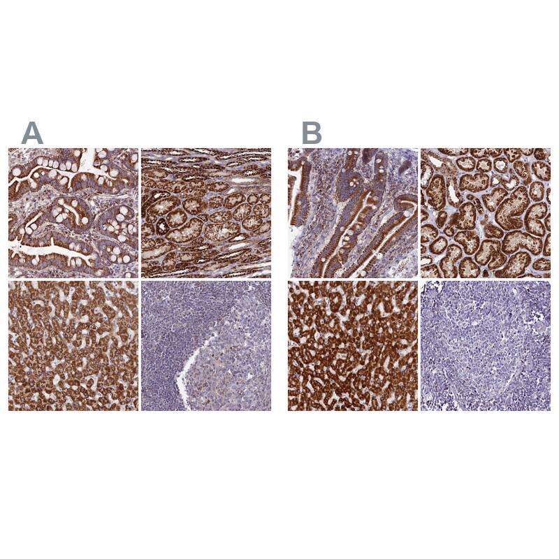 DCI Antibody - BSA Free Immunohistochemistry: DCI Antibody - BSA Free [NBP1-91822]