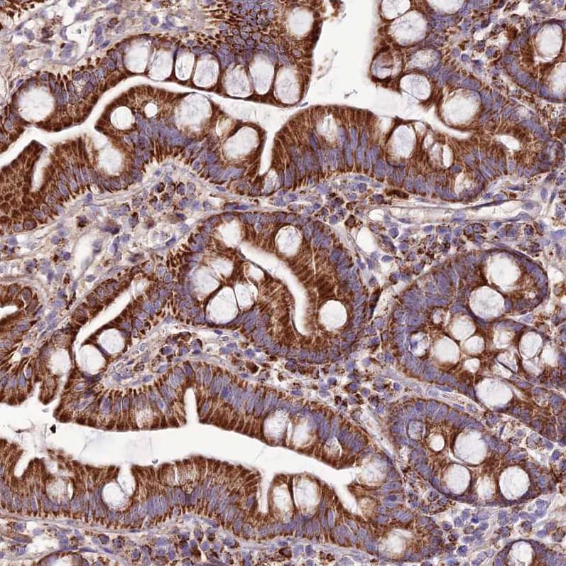 DCI Antibody - BSA Free Immunohistochemistry: DCI Antibody - BSA Free [NBP1-91822]