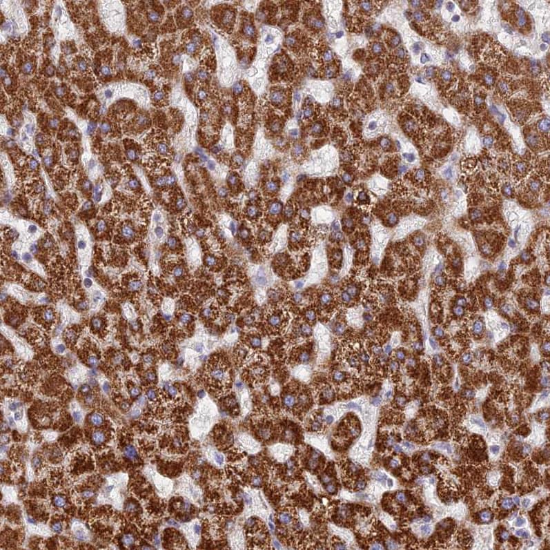 DCI Antibody - BSA Free Immunohistochemistry: DCI Antibody - BSA Free [NBP1-91822]