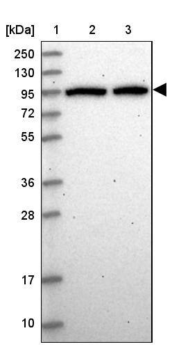 DDX27 Antibody - BSA Free Western Blot: DDX27 Antibody - BSA Free [NBP1-91825]