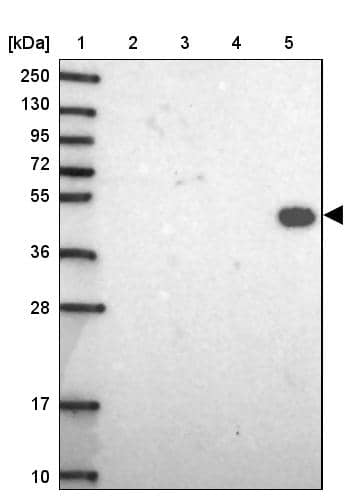 DMRTA1 Antibody - BSA Free Western Blot: DMRTA1 Antibody - BSA Free [NBP1-91838]