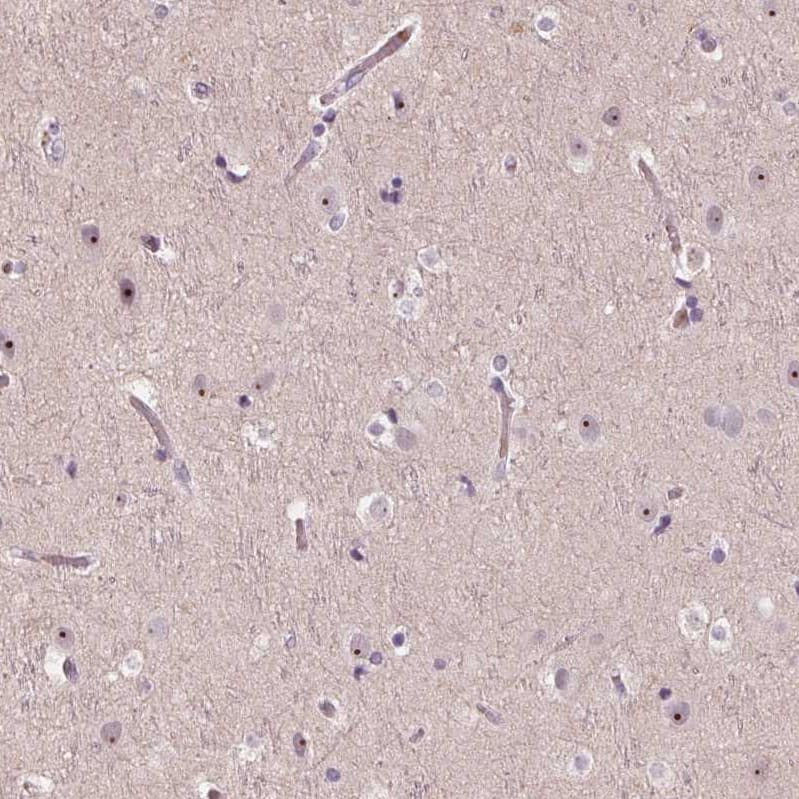 DNTTIP2 Antibody - BSA Free Immunohistochemistry: DNTTIP2 Antibody - BSA Free [NBP1-91845]