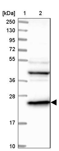 DTYMK Antibody - BSA Free Western Blot: DTYMK Antibody - BSA Free [NBP1-91850]