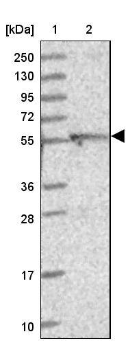 DUS2L Antibody - BSA Free Western Blot: DUS2L Antibody - BSA Free [NBP1-91852]